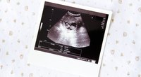 Embryo-Entwicklung: Was sich Woche für Woche beim Baby im Bauch tut