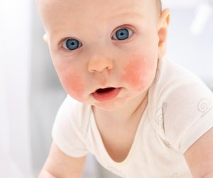 Trockene Haut bei Babys und Kindern: Hautärzte sagen, was wirklich hilft